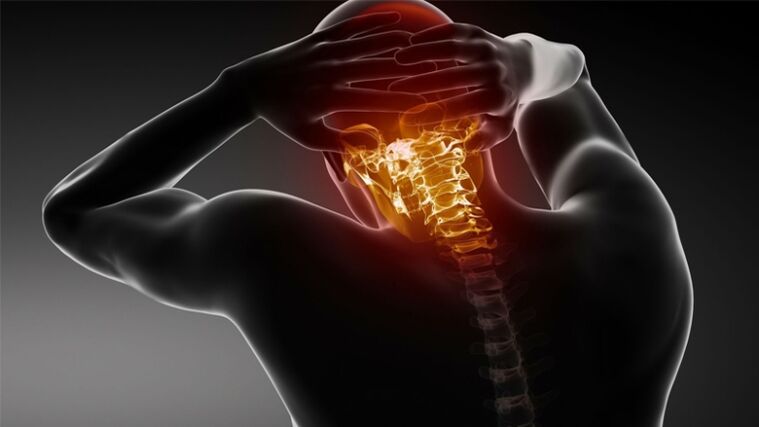 bolečine v zadnjem delu glave s cervikalno osteohondrozo